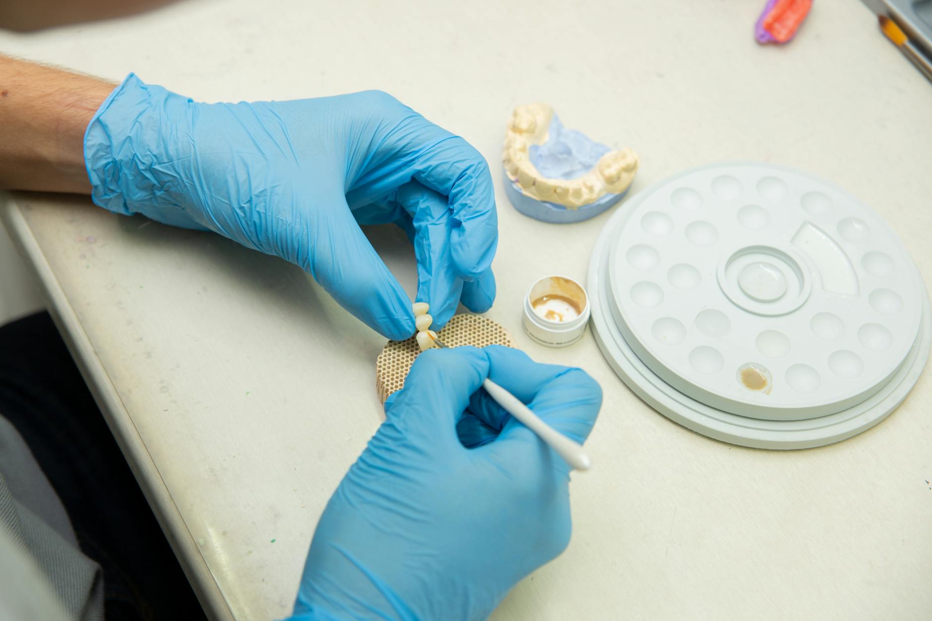 Stryker's $2.2 Billion in Hip Implant Settlements