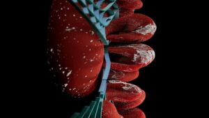 Cordis IVC Filter Complication Class Action - Featured image