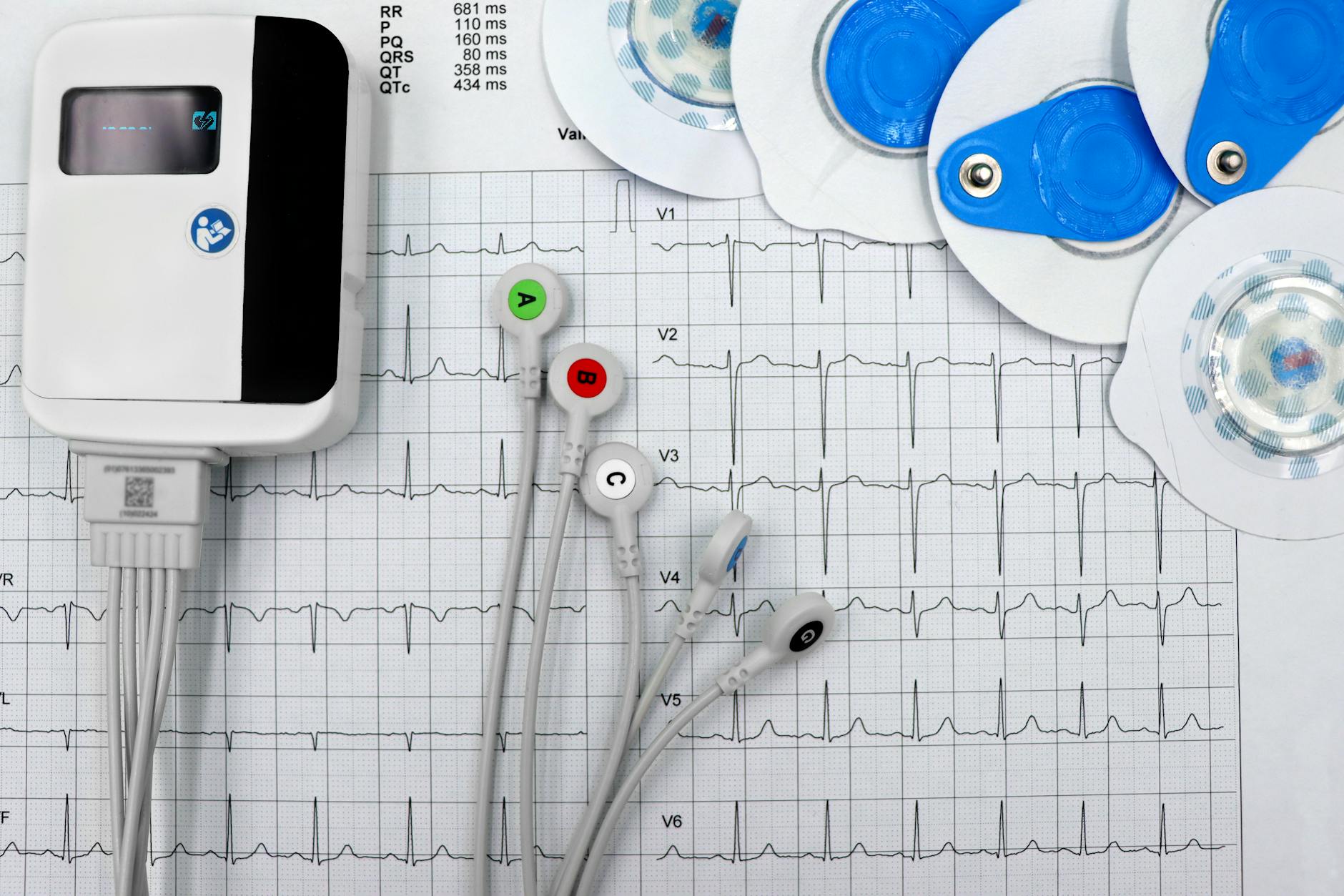 Medtronic Pacemaker Lead Failure Class Action - Featured image