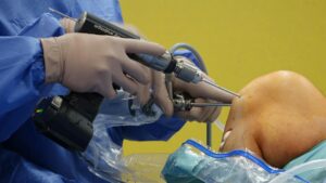 Stryker Rejuvenate Hip Implant Recall Class Action - Featured image