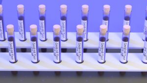 Co-Diagnostics CODX securities class action settlement