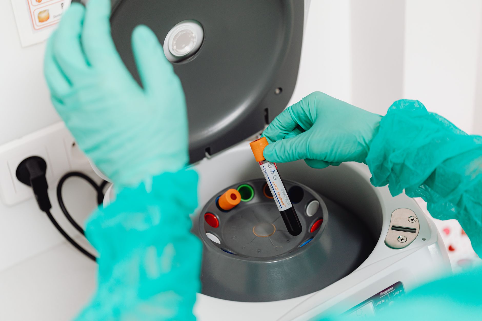 Labcorp website tracking class action settlement